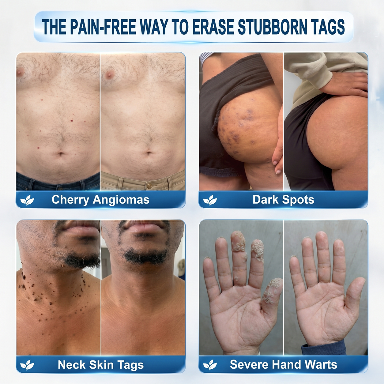 𝐏𝐡𝐚𝐫𝐦𝐚𝐜𝐢𝐬𝐭 𝐑𝐞𝐜𝐨𝐦𝐦𝐞𝐧𝐝𝐞𝐝 🍒🍒𝑯𝗲𝙖𝐥𝒓𝗶𝙯𝗲® 7-𝐷𝑎𝑦 𝗧𝐚𝐠 & 𝗦𝗽𝐨𝐭 𝐄𝐫𝒂𝒔𝒆𝒓🪄(Zero 𝐏𝐚𝐢𝐧, Zero 𝐒𝐜𝐚𝒓𝒔 Rollerball)👩‍⚕️